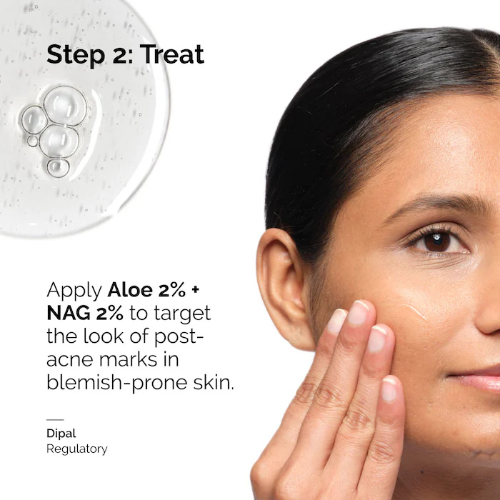 Aloe 2% + NAG 2% Solution Seru - огляд і ціна Aha Bha Exfoliant