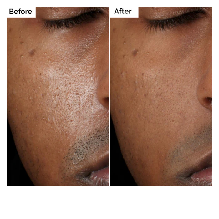 Aloe 2% + NAG 2% Solution Seru - огляд і ціна Aha Bha Exfoliant