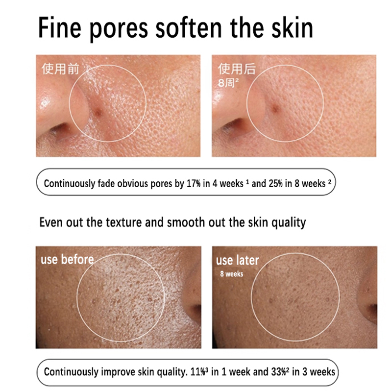 Aloe 2% + NAG 2% Solution Seru - огляд і ціна Aha Bha Exfoliant