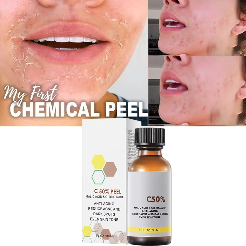 With Malic Acid And Citric Aci - огляд і ціна Salicylic Acid Cleanser