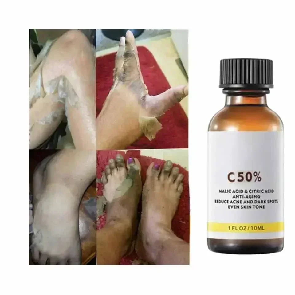 With Malic Acid And Citric Aci - огляд і ціна Salicylic Acid Cleanser